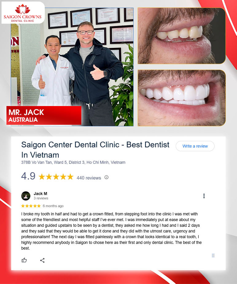 customer review 1 1 customer review 1 1