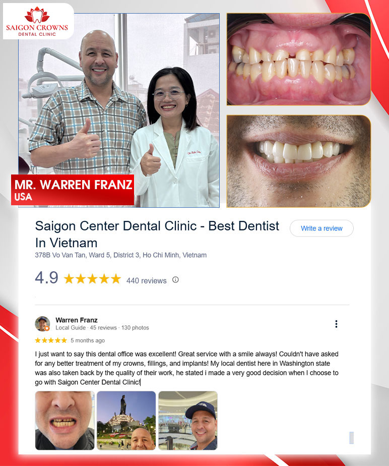 customer review customer review