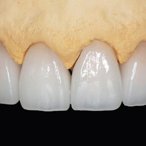 emax 1x1 1 emax 1x1 1