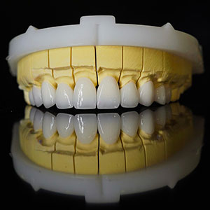 orodent 1x1 1 orodent 1x1 1